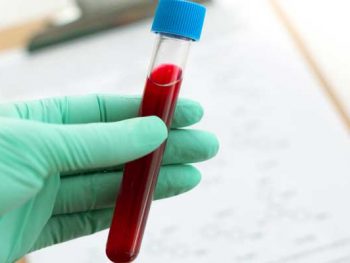 Para que serve o hemograma, o popular exame de sangue
